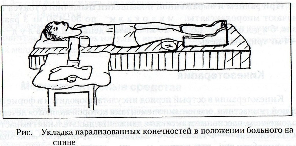 Постинсультный уход